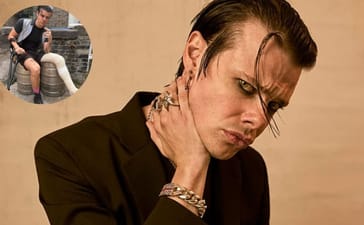 Yungblud broken leg