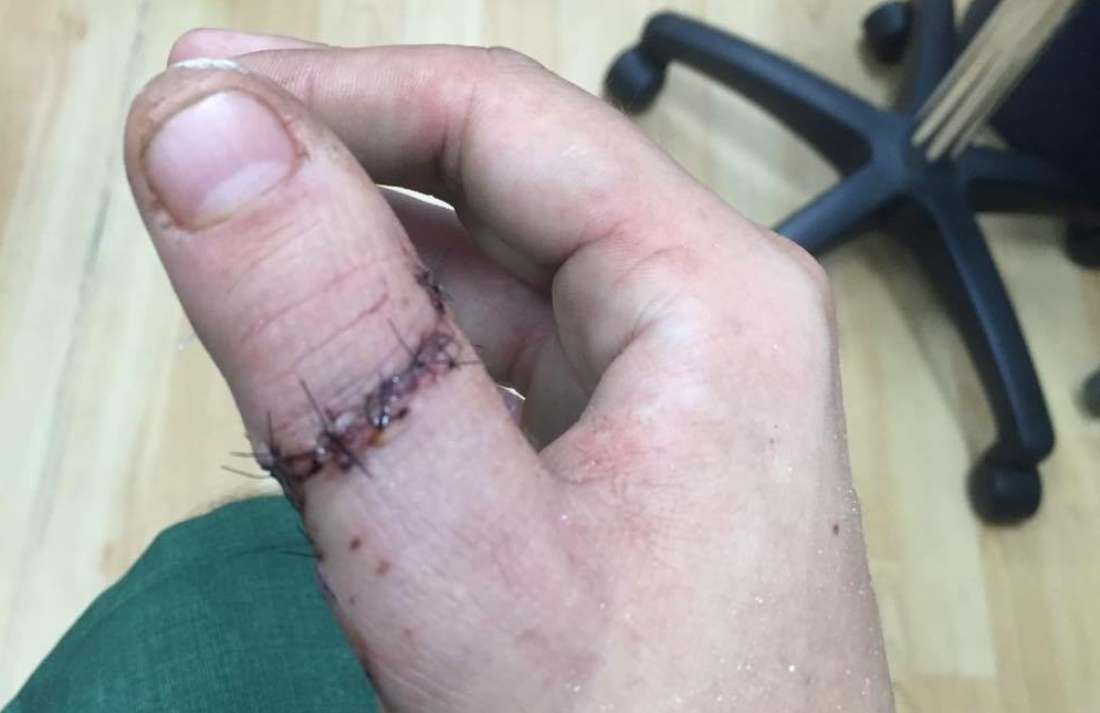 Nerdlinger accident